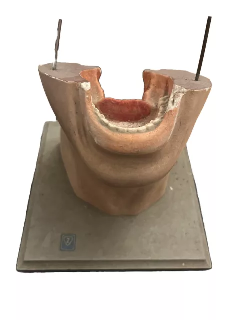 Antique Vintage Throat And Larynx From The Hygiene Museum Dresden Anatomical