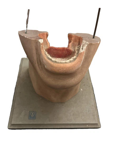 Antique Vintage Throat And Larynx From The Hygiene Museum Dresden Anatomical
