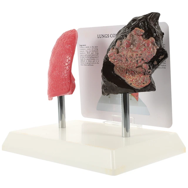 TEACHING RESPIRATORY LUNG Model Structure Mold Pathological £38.65 ...