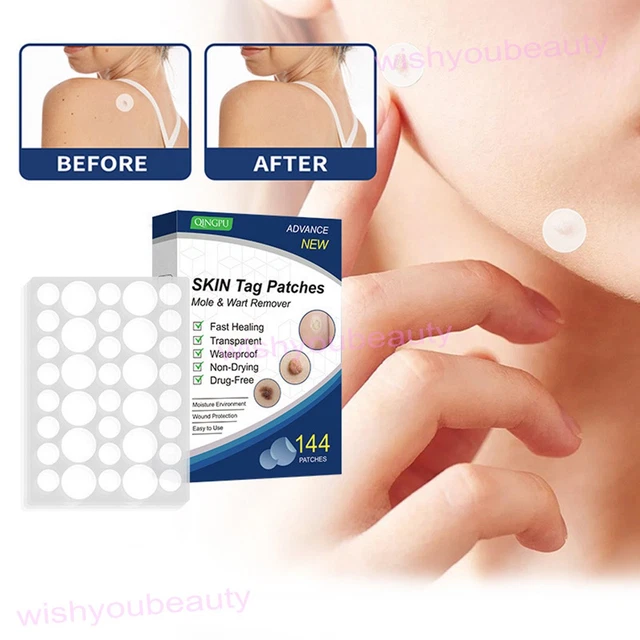 144 Patches/stickers Removeur De Skin Tags (excroissances) - Rapide Et Efficace - Pour Tous Types De Peau - Neuf