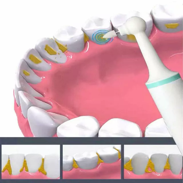 Polisseur de dents électrique spot Remover + tête de remplacement 3