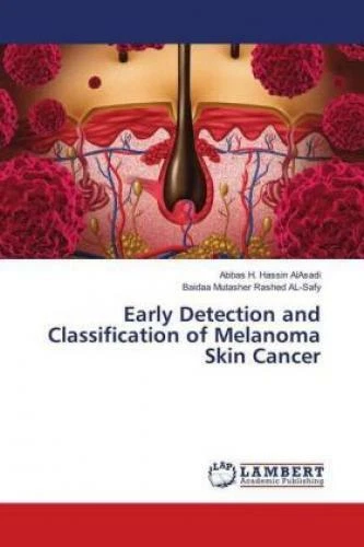 EARLY DETECTION AND Classification of Melanoma Skin Cancer 3392 £40.03 ...