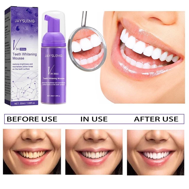 de couleur Nettoyage oral Blanchiment des dents Dentifrice blanchissant