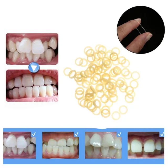 Medical Grade Rubber Latex Rings Dental Rubber Bands Orthodontic Rings Elastics