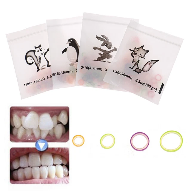 100pcs Color Dental Elastic Band Dental Orthodontic Rubber B~DC