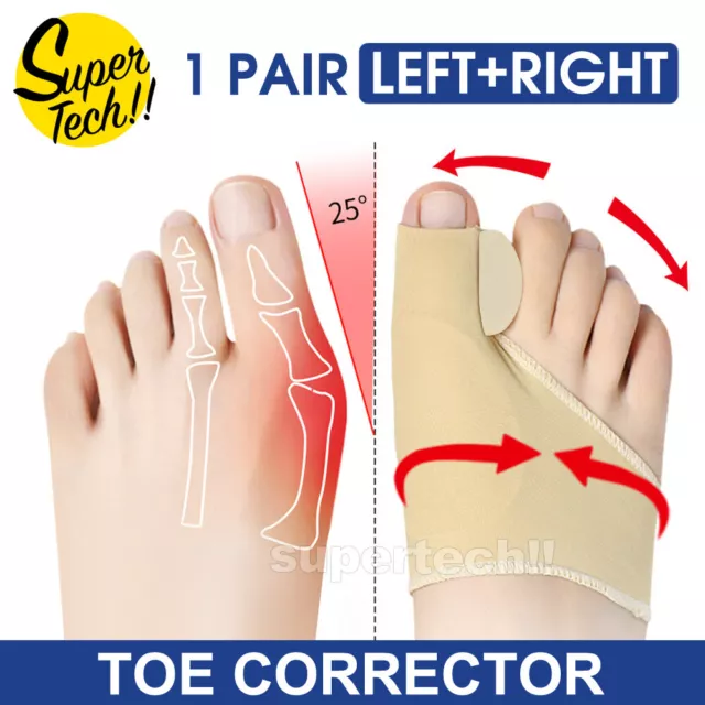 Bunion Corrector Big Toe Splint Straightener Hallux Valgus Foot Separator Hammer