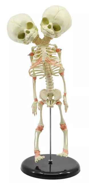 Infant Fetus Skeleton Model, Mini Size - Twin, Conjoined Skull - Rod Mounted - I