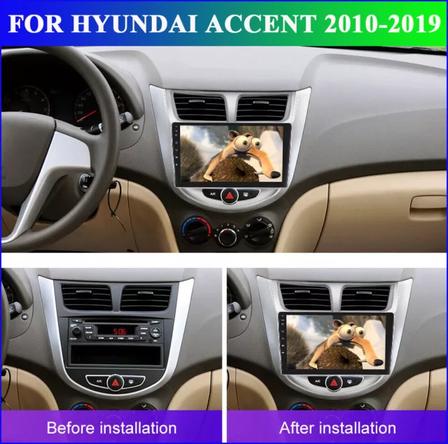 Android 13 For Hyundai Accent 2010-2019 Carplay Car Stereo Radio Gps Head Unit