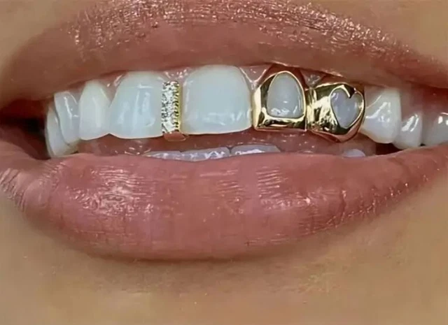Griglie In Oro Per Denti, Grillz In Oro Lucido Hip Hop Placcato - Foto 6