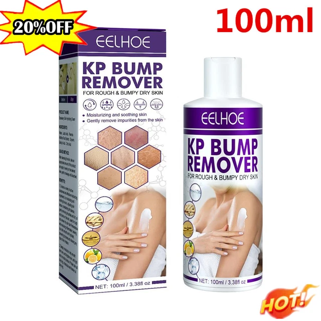 100ML KERATOSIS PILARIS Repair Cream Exfoliating For Folliculitis Cream