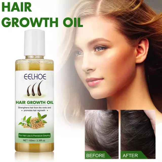 Aceite para el crecimiento del cabello - aceite acondicionador del cabello ayurvédico para el cabello;
