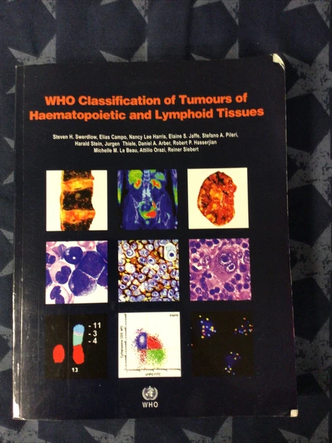 WHO CLASSIFICATION OF tumours of haematopoietic and lymphoid tissues ...