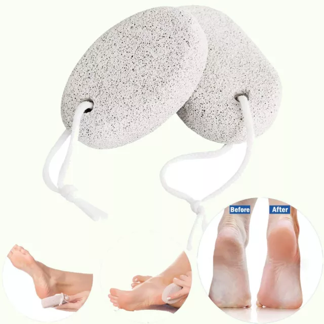 Stone for Feet 2 PCS Set, Foot Care Natural Pummice Stones for Dead Hard Skin