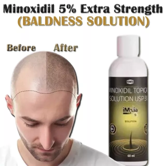 Minoxidil 5% fuerza extra suministro de 3 meses crecimiento del cabello para hombres