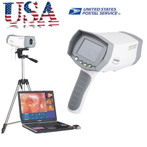 Video Colposcope 800,000 Camera Electronic Vaginoscopy Tripod Software-CAREJOY