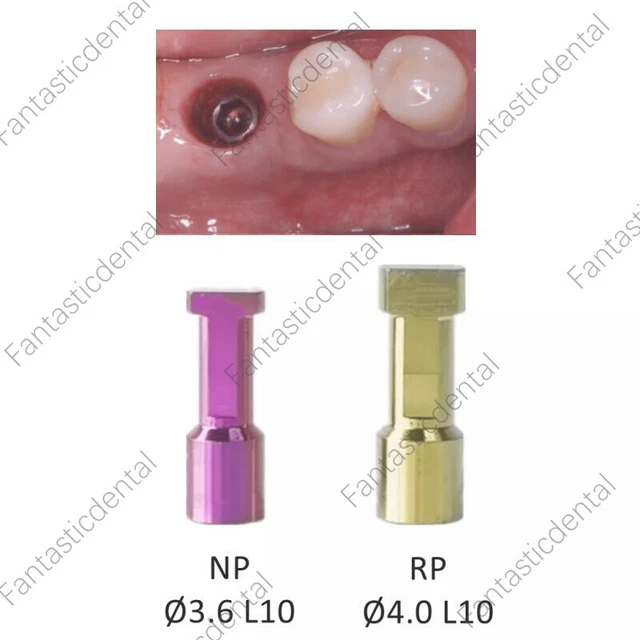 Dental Nobel Healing Abutment Conical Connection Compatible Nobel