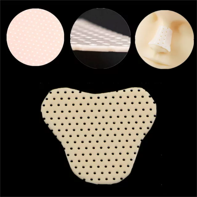 Low Temperature Thermoplastic Nasal Clamp Plate Surgery Plate Orthopedic Fix BII