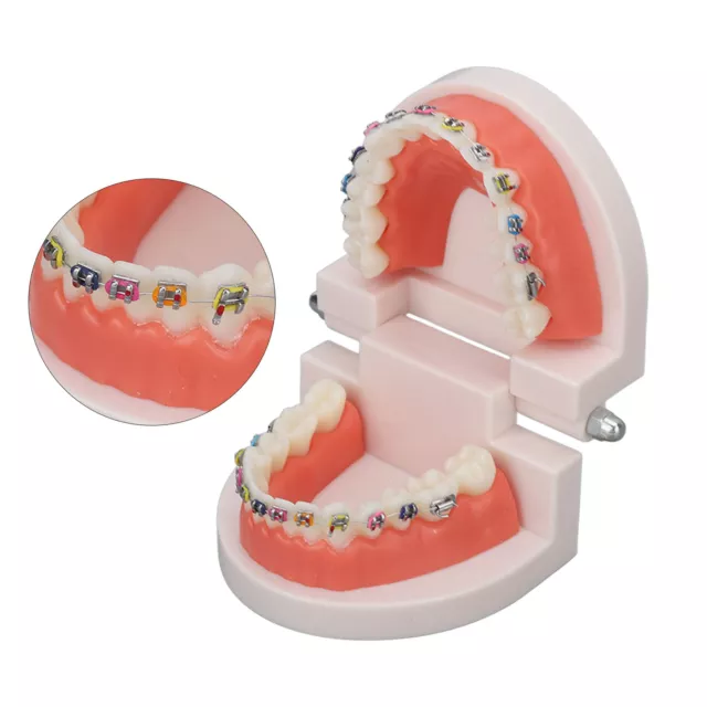 Dental Typodont Teeth Model With Orthodontic Metal Bracket For Dentist IDS