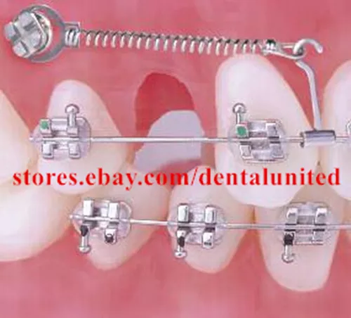 100pcs Dental Orthodontic Crimpable Long Curved Power Hooks Right&Left 5pks each