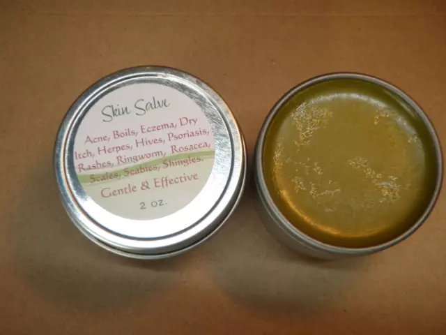 Skin Salve: Heals Infections, Relieves pain & itch, Clears rashes & Soothes~Fast