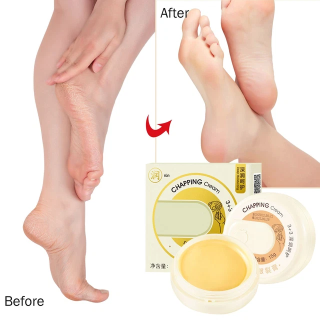 Productos hidratantes y para el cuidado de los pies para la protección de las grietas secas manos y pies
