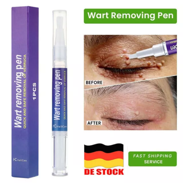 Wirksamer Warzenentferner Stift Skin Tag Mole Remover Beseitigt Hornhautwarzen 3