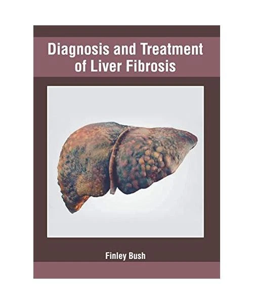 DIAGNOSIS AND TREATMENT of Liver Fibrosis EUR 90,54 - PicClick FR