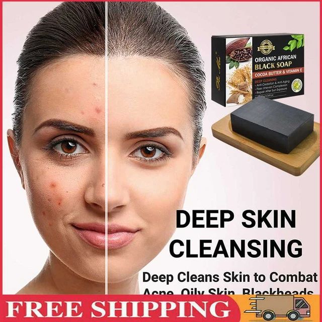 120 g jabón negro antibacteriano jabón de limpieza natural eliminar puntos negros cuidado de la piel