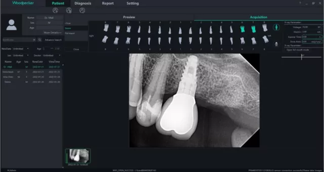 Woodpecker I Sensor Dental X Ray Digital Radio Graphic RVG Sensor Taille 2 2