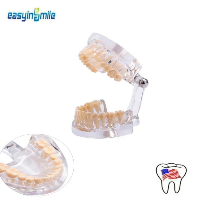 Dental Teeth Model Typodont Demonstration Standard Tooth Study Models Clear 1pc