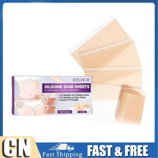 4 un. hojas de cicatrices de silicona tiras de gel parche adhesivo elimina cicatrices (75 mm)
