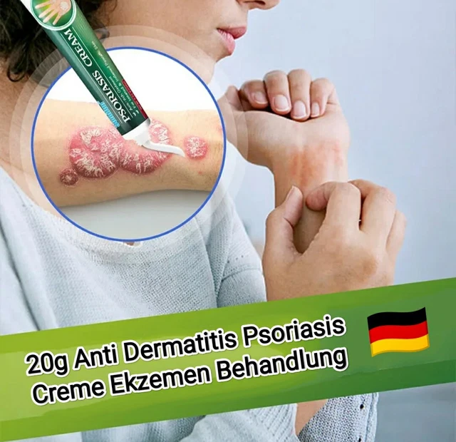 Crème 15g Pour Psoriasis Et Dermatite - à Base De Plantes, Hydratante, Corps Et Visage