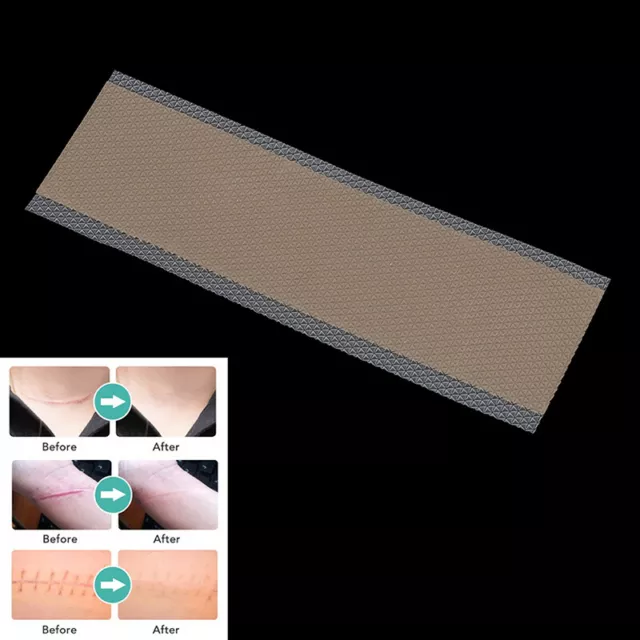 Hoja de gel de silicona tratamiento de cicatrices terapia eliminación de heridas piel Rep`Z8