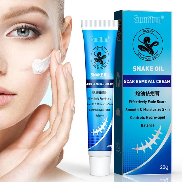 Healing Scar Cream Remove Burns Cuts Ointment Powerful Marks Skin-Repair M0I0