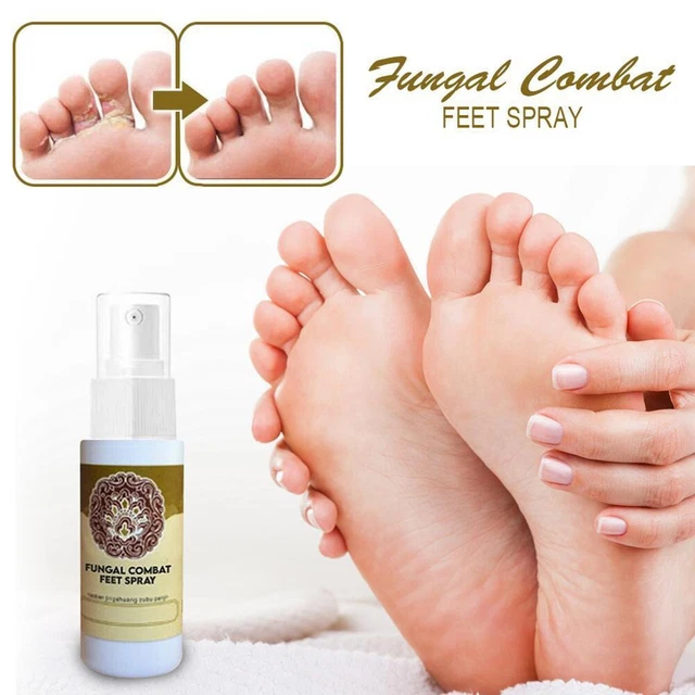 ANTIFUNGAL TREATMENT FEET Spray Infections Athlete Nail Foot Spray