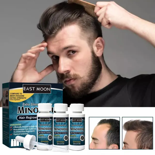 3 piezas/juego de soluciones de tratamiento líquido para el crecimiento del cabello minoxidil 5% extra fuerte para hombres