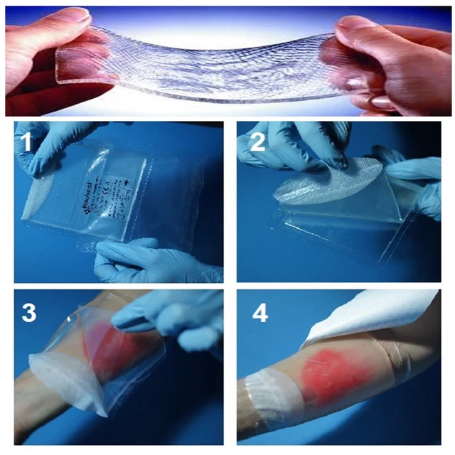 HYDROGEL DRESSINGS DIFFICULT Wounds Regeneration Medical Ulcers Sores