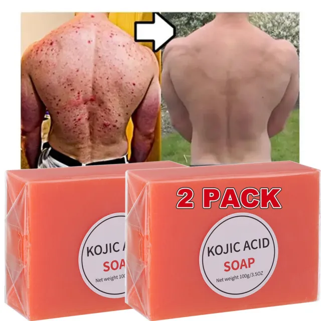 2 PCS Kojic Acid Soap Facial Cleaning Pores Dirt Acne Blackhead body Whitening