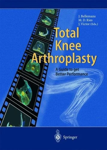 TOTAL KNEE ARTHROPLASTY: A Guide to Get Better Performance-Johan £34.01 ...