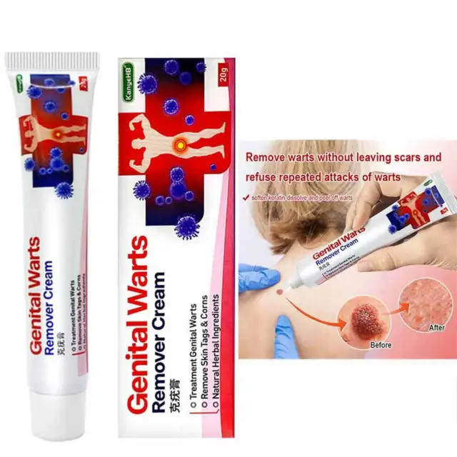 2Pcs Genital Herpes Wart Remover Cream Skin Tag Mole Acuminatum Treatment Cream