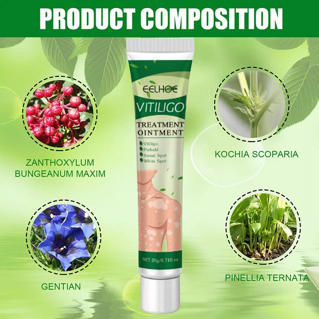 20 g crema trattamento vitiligine promozione melanina sudore crema macchie forniture per la cura della pelle