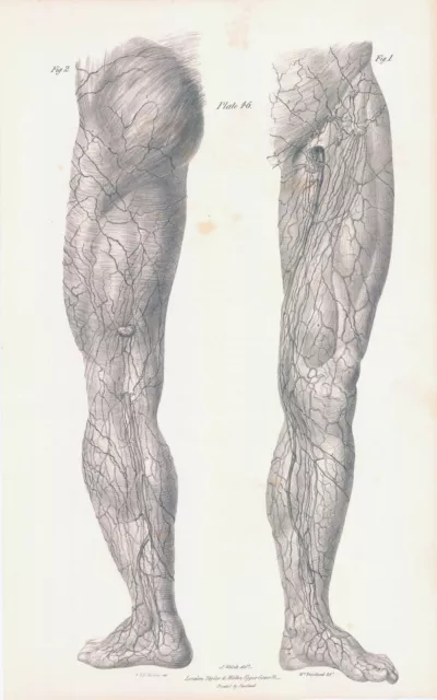 1837 Large Engraving ANATOMY Vascular Leg Knee Foot Buttock Groin (VA-46)