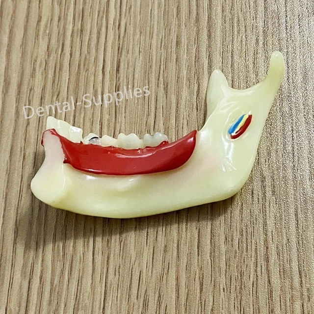 DENTAL ANATOMICAL MANDIBULAR Teaching Model Anatomy Of Gums Study ...