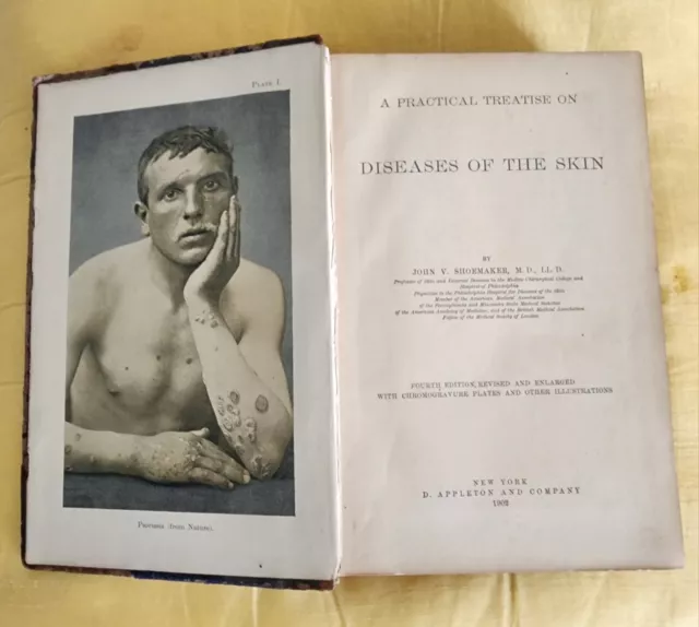 1902 Book A Practical Treatise On Diseases Of The Skin Shoemaker