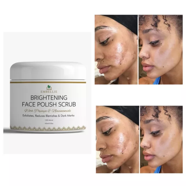 Brightening Face Scrub, Face Polish, Exfoliator