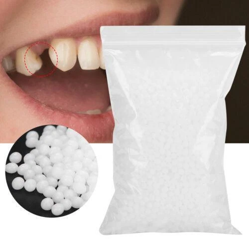 Kit Riparazione Denti Temporanei per Denti Mancanti o Rotti | Materiale Otturazione Dentale