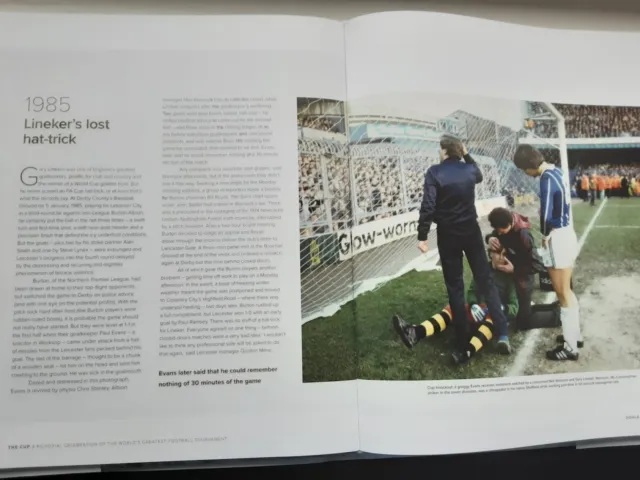 Burton Albion FC 1985 FA Cup v Leicester - Picture Paul Evans Having Treatment