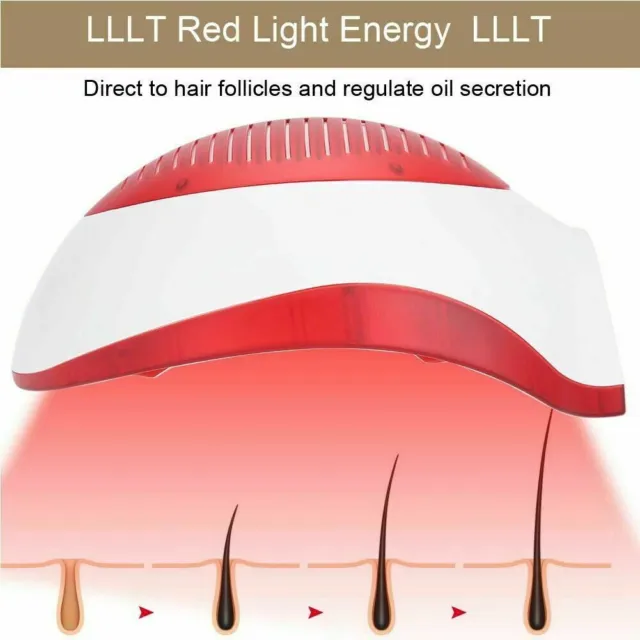 LLLT Laser Hair Regrowth Helmet Anti Hair Loss  Hair Growth Treatment  A+
