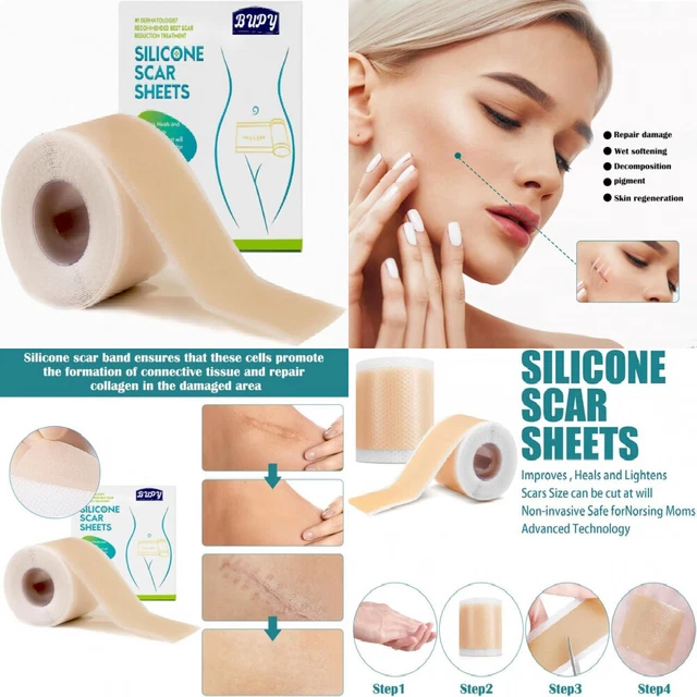 Cerotto In Silicone Trasparente Per Cicatrici 2,5 X 150 Cm - Leviga E Ammorbidisce Cicatrici Chirurgiche, Cesarei, Ustioni - 2