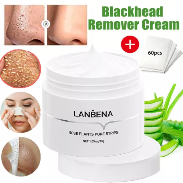 LANBENA Blackhead Remover Cream Facial Nose Mask Plant Pore Strips Acne Peel-Off